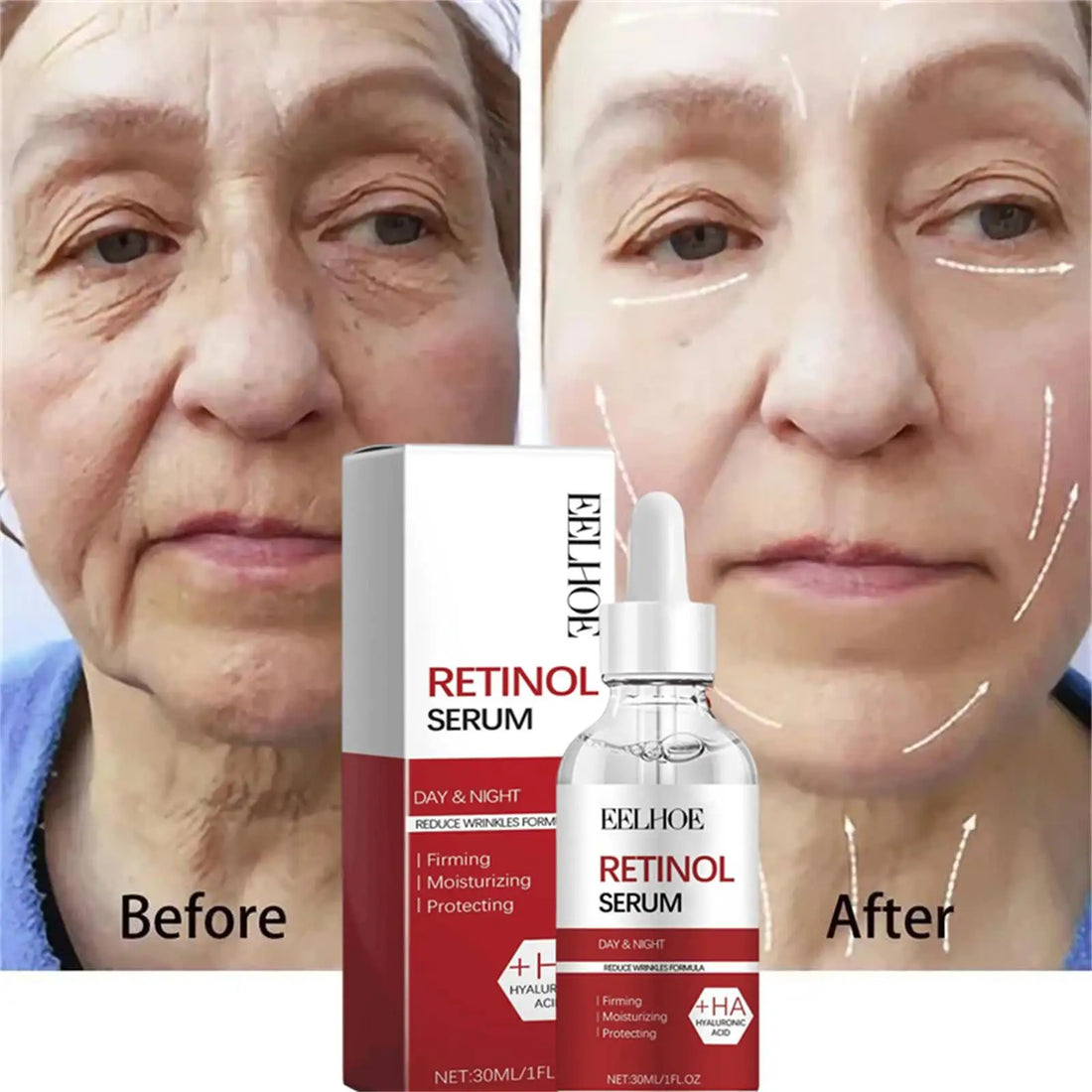Retinol Anti-Aging Face Serum Set