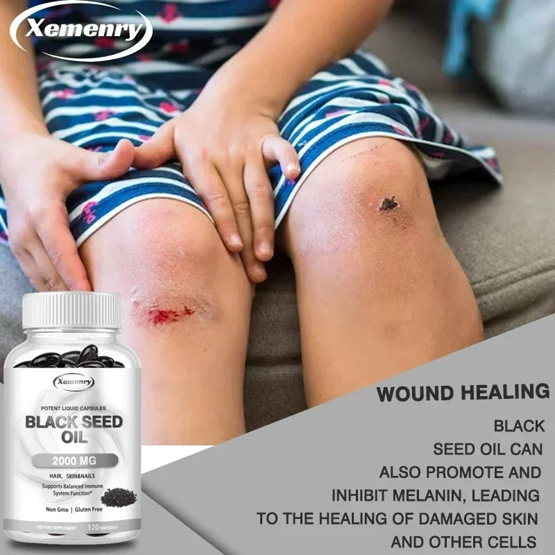 Black Seed Oil 2000 mg Capsules — Nourish Hair Growth, Skin & Nails, Support Immunity & Daily Vitality (60 / 120 Capsules)