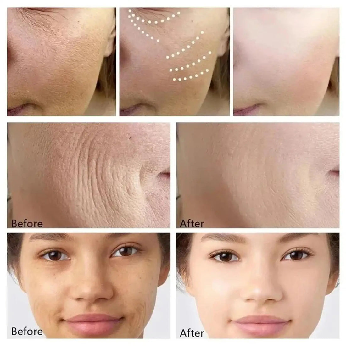 Retinol Anti-Aging Face Serum Set