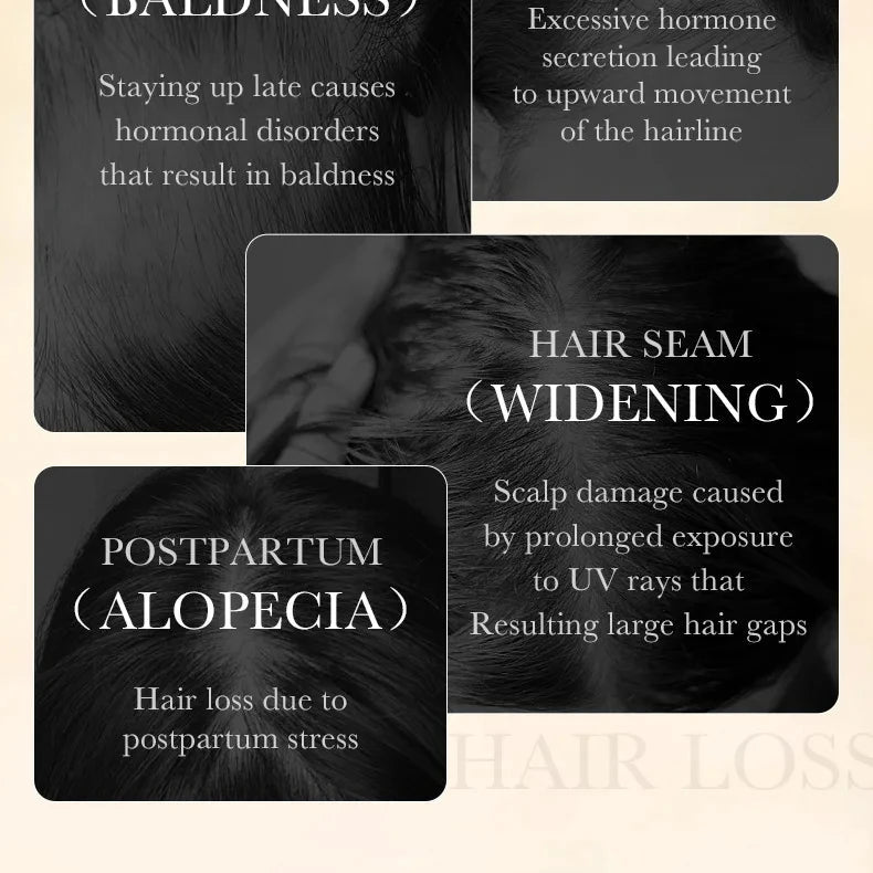 Hair Growth Essential Regrowth Serum — Anti-Hair Loss Nourishing Scalp Essence with Polygonum Extract, Peptides & Hyaluronic Complex (30 ml)