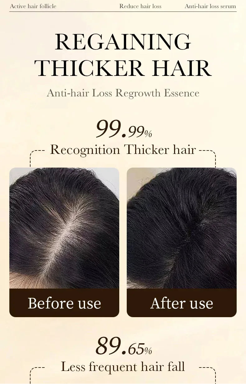 Hair Growth Essential Regrowth Serum — Anti-Hair Loss Nourishing Scalp Essence with Polygonum Extract, Peptides & Hyaluronic Complex (30 ml)