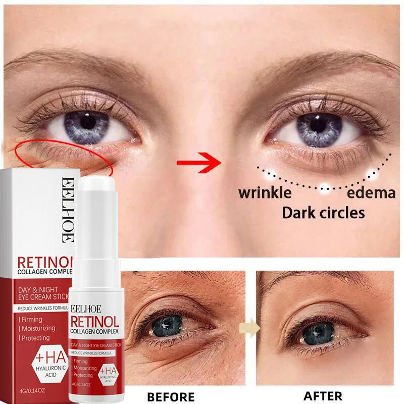 Retinol Anti-Aging Face Serum Set
