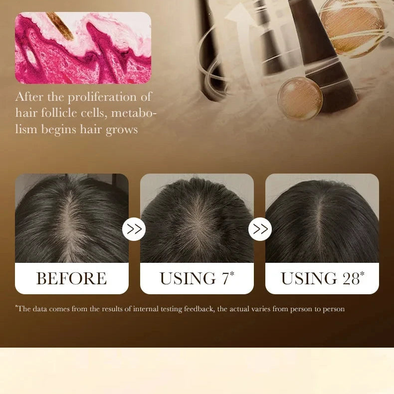 Hair Growth Essential Regrowth Serum — Anti-Hair Loss Nourishing Scalp Essence with Polygonum Extract, Peptides & Hyaluronic Complex (30 ml)