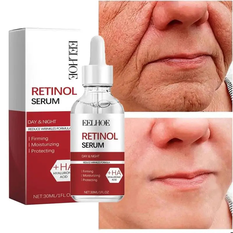 Retinol Anti-Aging Face Serum Set