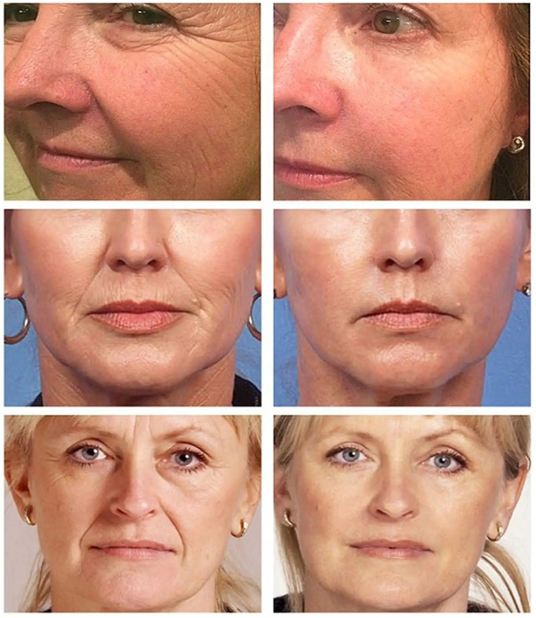 Retinol Anti-Aging Face Serum Set
