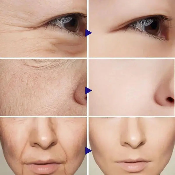 Retinol Anti-Aging Face Serum Set