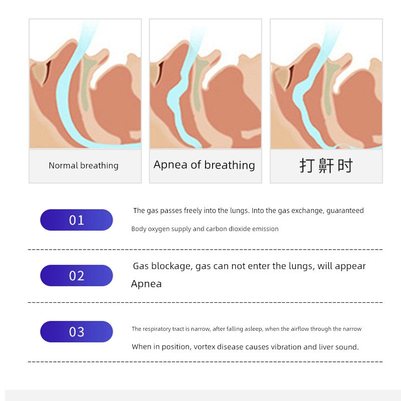 Smart Anti-Snoring Ring — Silent Sleep Support for Adults (Home Use, Unisex Snore Reducer)