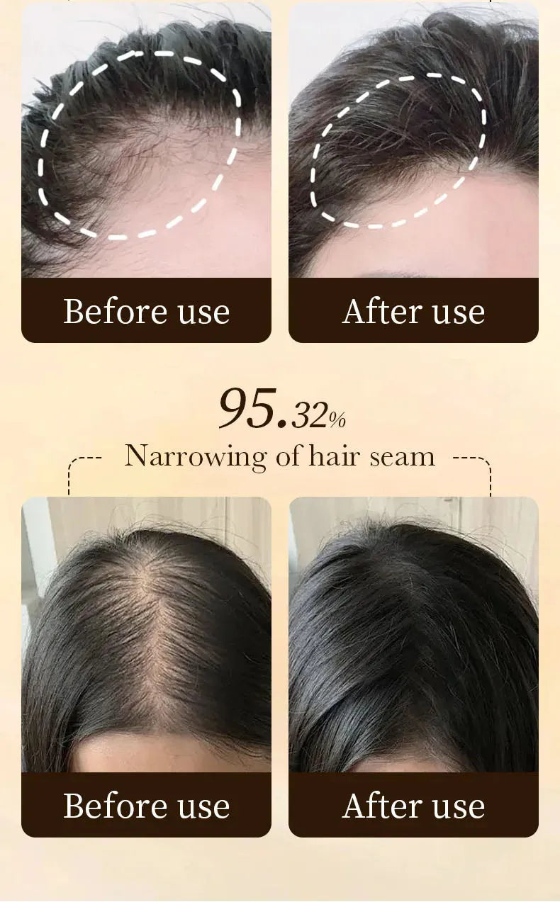 Hair Growth Essential Regrowth Serum — Anti-Hair Loss Nourishing Scalp Essence with Polygonum Extract, Peptides & Hyaluronic Complex (30 ml)