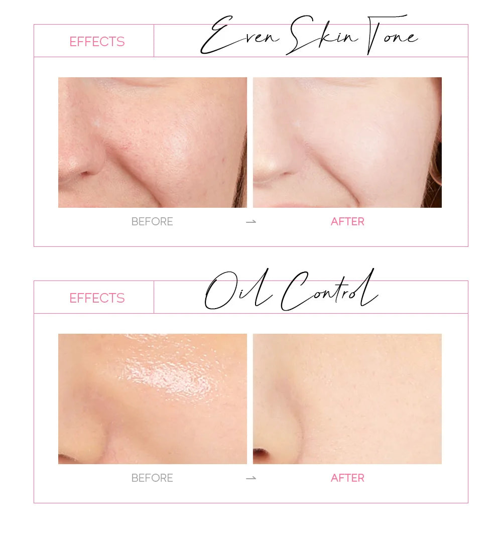 LAIKOU Sakura 24K Gold Peeling Mask